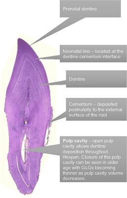 How to estimate age of old bottlenose dolphins (Tursiops truncatus); by tooth or pectoral flipper?